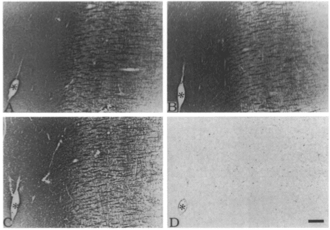 Image thumbnail for Anti-Myelin Basic Protein (region 119-131) [MBP2]