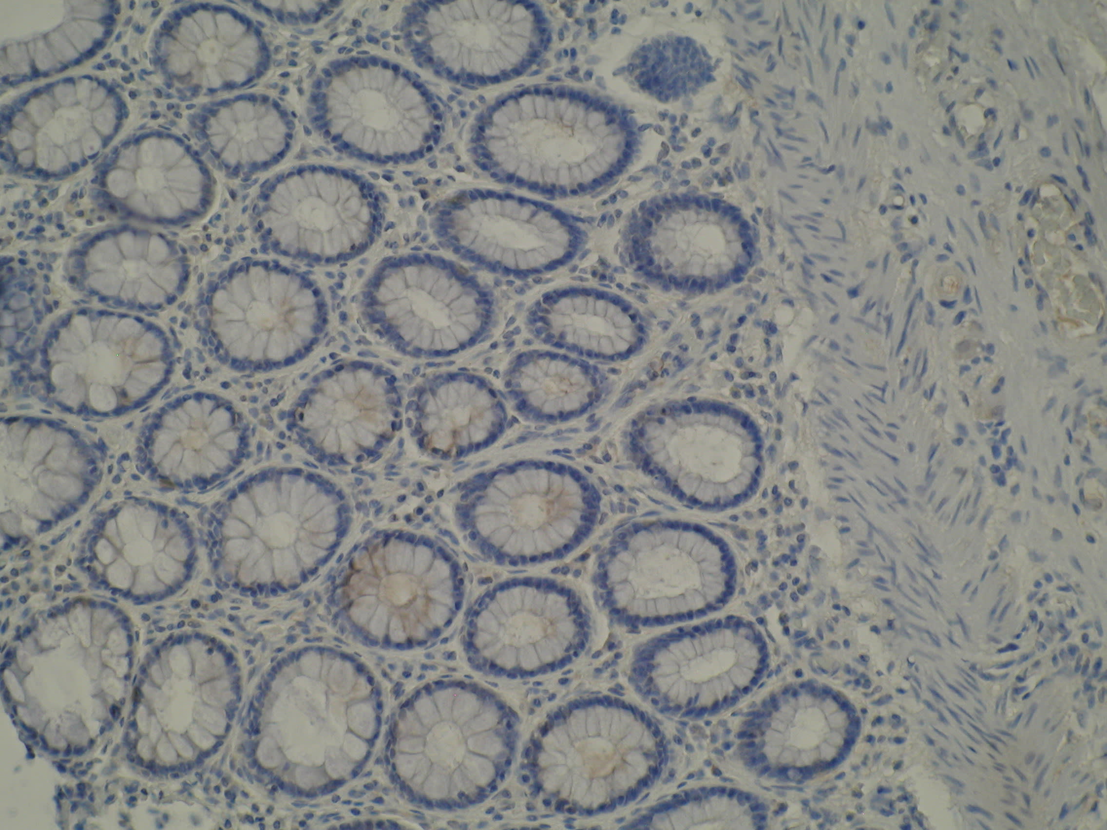 Image thumbnail for Anti-Cytochrome P450 39A1 [M30P6D6]