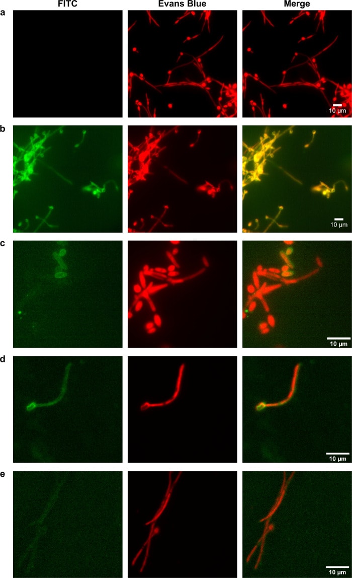 Image thumbnail for Anti-Alcohol dehydrogenase 1 [Ca37] monoclonal antibody