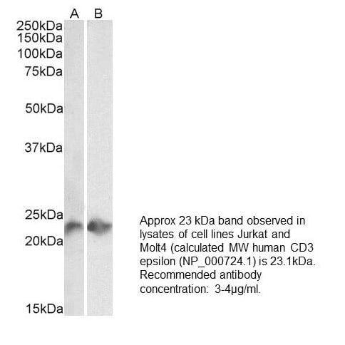 Image thumbnail for Anti-CD3, Recombinant [UCH-T1<sup>®</sup>]