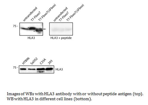 Image thumbnail for Anti-Fbxo7, Polyclonal [HLA3]