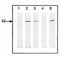 Image thumbnail for Anti-HPV16E2 [TVG 271]