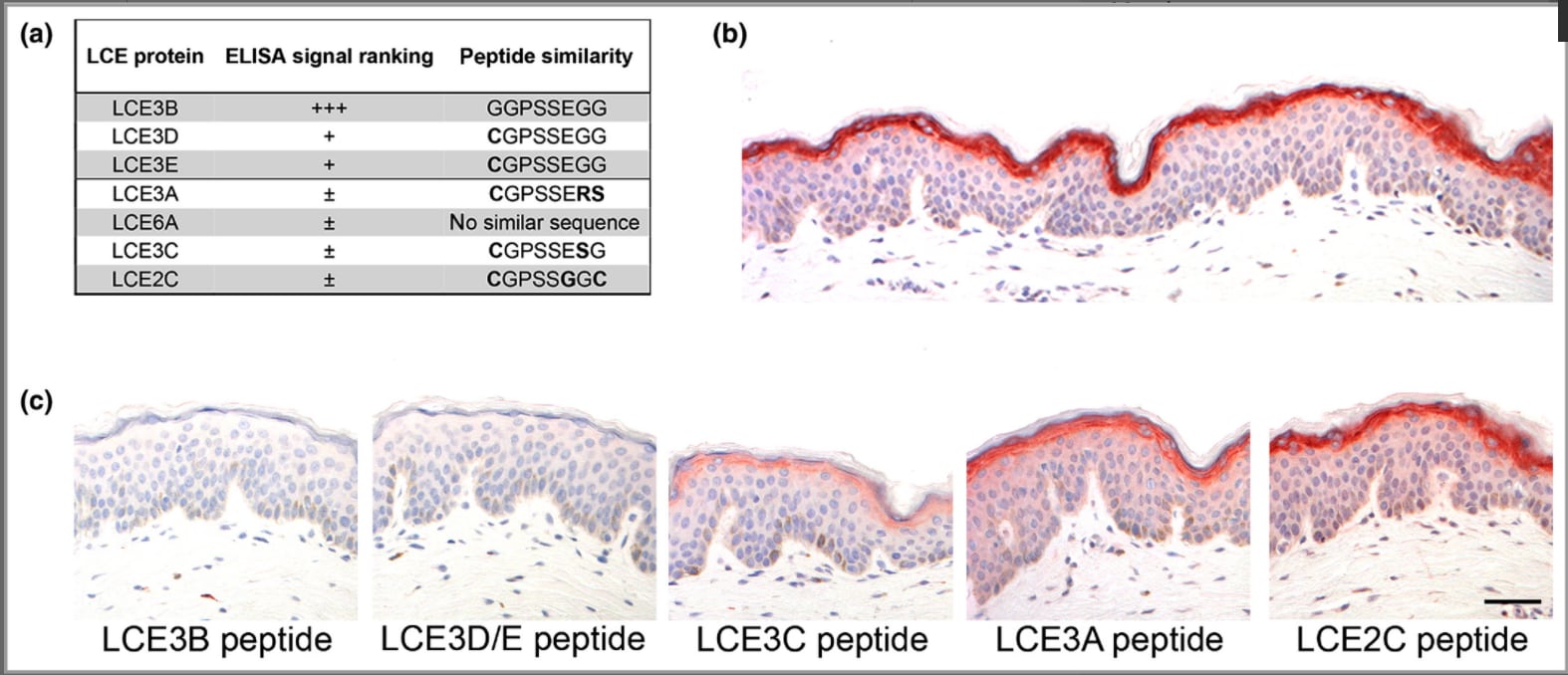 Image thumbnail for Anti-pan-late cornified envelope 3, pan-LCE3 [7] monoclonal antibody