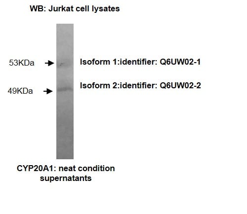 Image thumbnail for Anti-Cytochrome P450 20A1 [Z27-P3H7*E3]