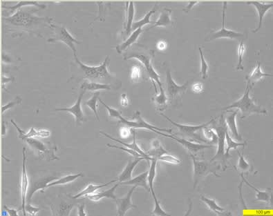 Image thumbnail for MEF ULK1/2 WT(SV40) Cell Line