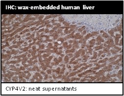 Image thumbnail for Anti-Cytochrome P450 4V2 [M29-P3B10]