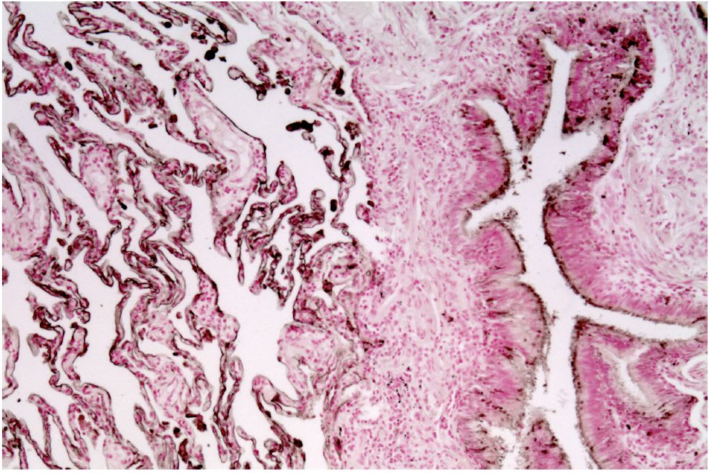 Image thumbnail for Anti-CEACAM6 (CD66c) [1H7-4B] monoclonal antibody