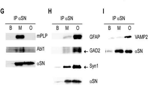 Image thumbnail for Anti-Proteolipid protein [PLPC1]