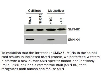 Image thumbnail for Anti-SMN2 [SMN-KH]