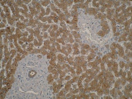 Image thumbnail for Anti-UCP2 [A1P2A9*F5] monoclonal antibody