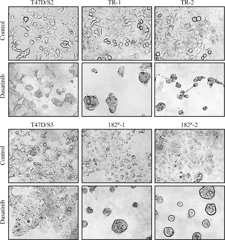 Image thumbnail for T47D-182R2 Cell Line