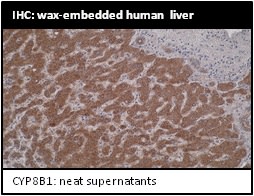 Image thumbnail for Anti-Cytochrome P450 8B1 [M15-P3B7]