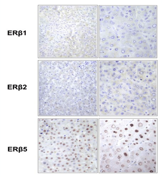 Image thumbnail for Anti-Estrogen Receptor ß2 [57/3]