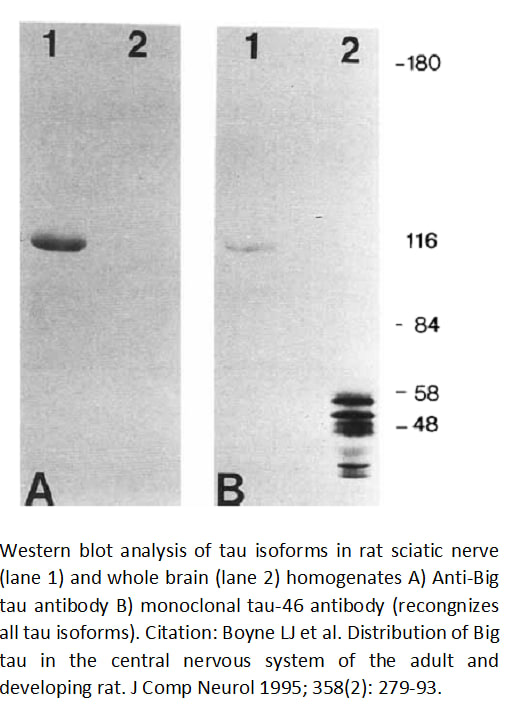 Image thumbnail for Anti-Big (high-molecular-weight) tau, Polyclonal antibody