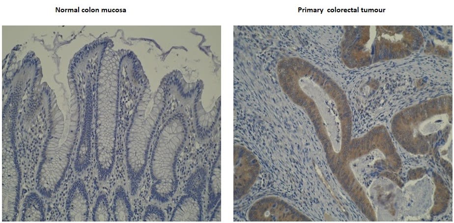 Image thumbnail for Anti-Cytochrome P450 4V2 [M29-P3B10]