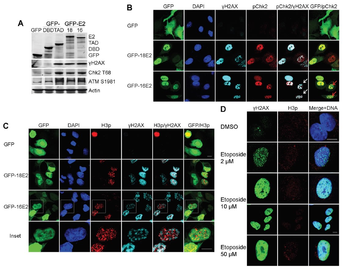 Image thumbnail for Anti-HPV16E2, Polyclonal [HPV16E2]