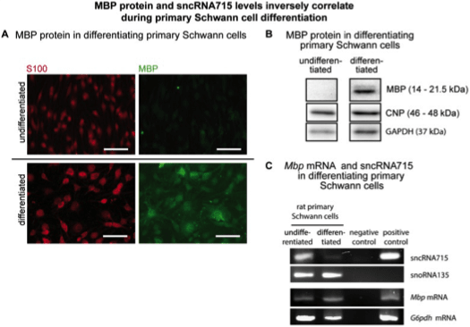 Image thumbnail for Anti-Myelin Basic Protein [MBP40]