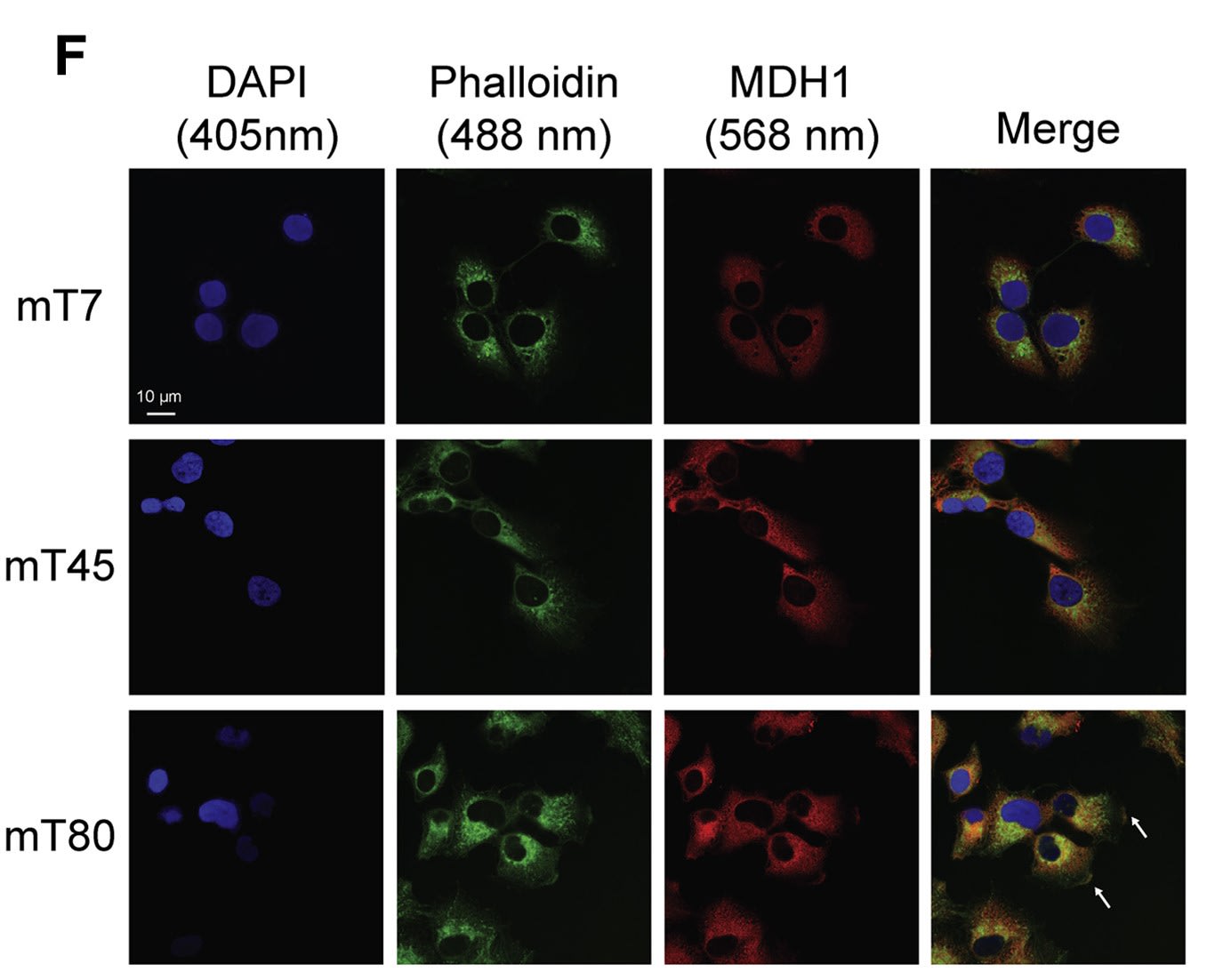 Image thumbnail for 143B m.8993T>G isogenic mTUNE mT10 Cell Line