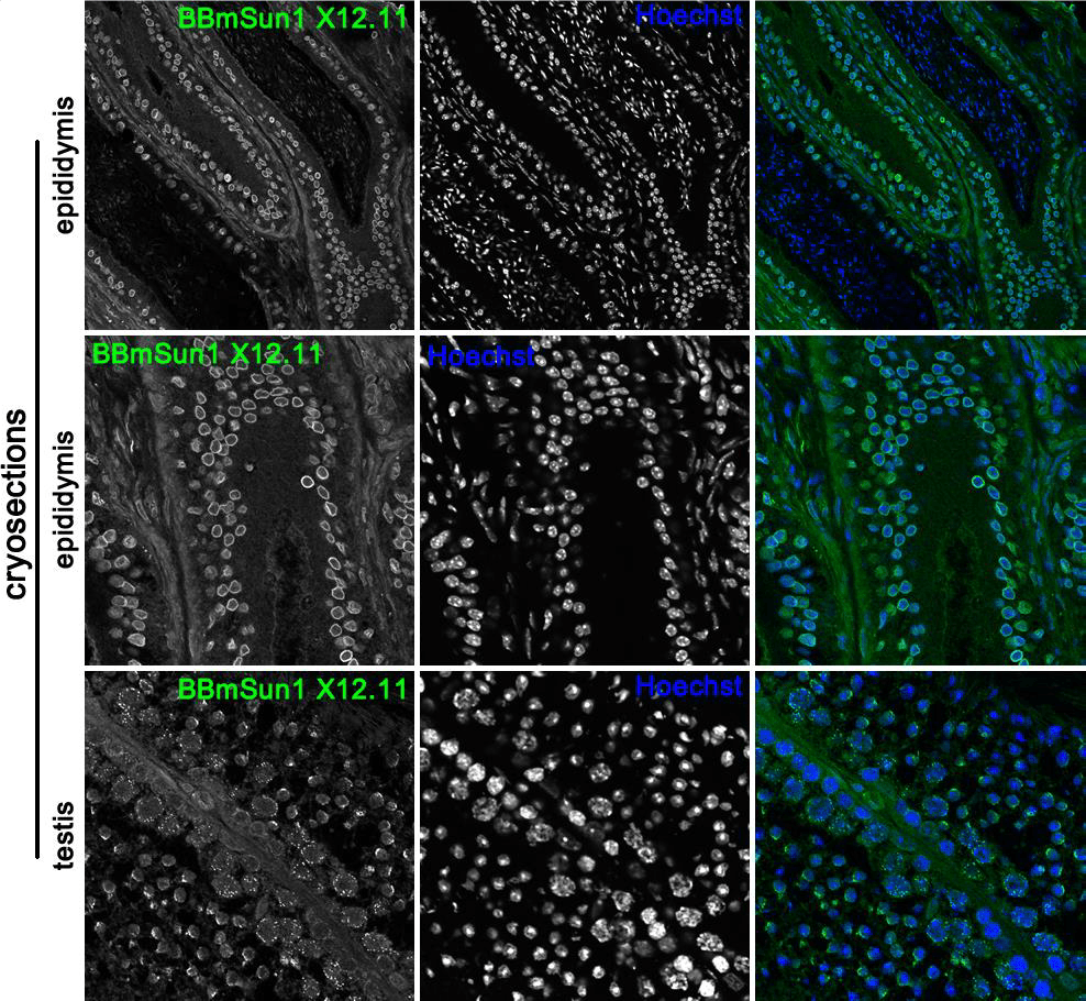 Image thumbnail for Anti-Sun1 [BBmSun1 X12.11] monoclonal antibody