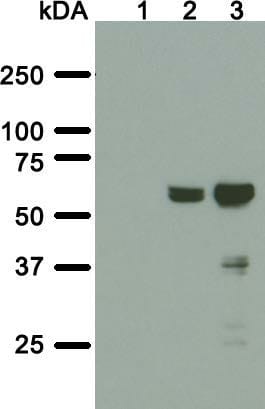 Image thumbnail for Anti-A. aeolicus BPL/BioID2 [SS 3A5-E2]