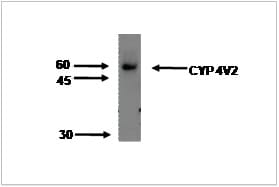 Image thumbnail for Anti-Cytochrome P450 4V2 [M29-P3B10]