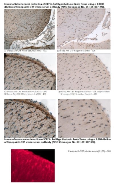 Image thumbnail for Anti-CRF polyclonal antibody (Whole Serum, Sheep)