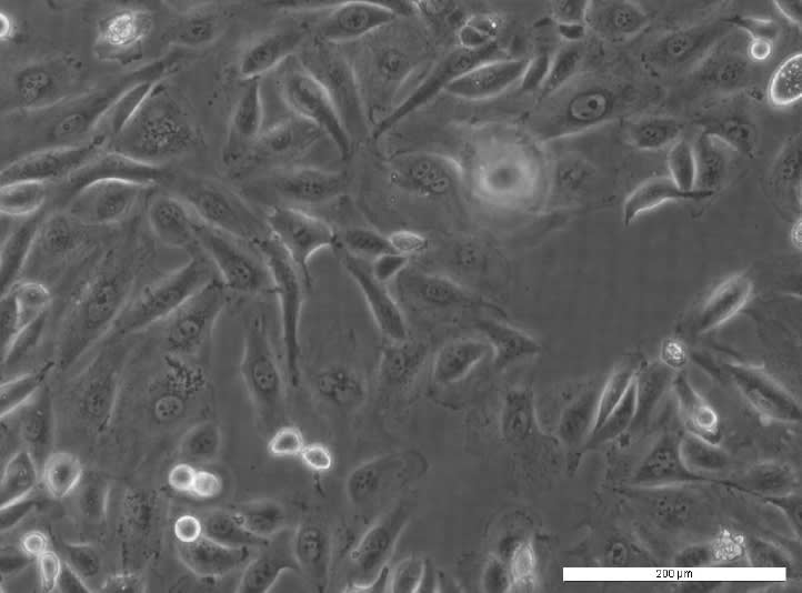 Image thumbnail for PEA1 Cell Line
