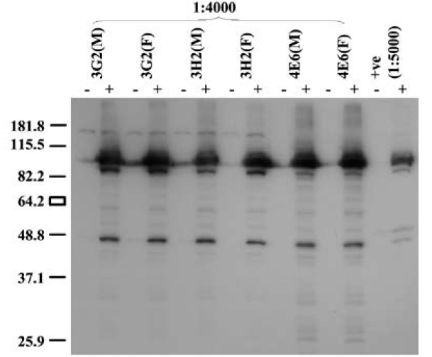 Anti R2 4e6 Monoclonal Antibodies Ximbio