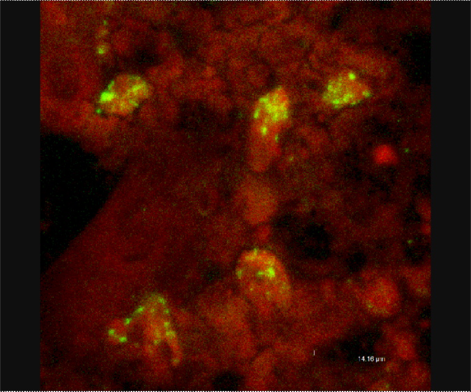 AntiMetapneumovirus [hMPV57] Monoclonal Antibodies Ximbio