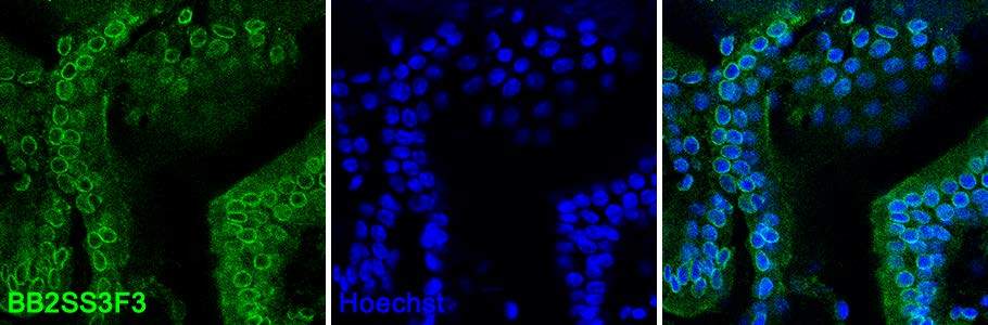 Alexa Fluor 647 Anti Lamin B2 Antibody Epr9701 B Ab200427 Abcam