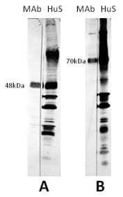 The antigen in all lanes was gradient purified RSN-A2 virus (subgroup A). First antibodies: Lanes “MAb”: 11-3-A3 antibody; Lanes “HuS”: RS virus convalescent human sera. Panel A: Antigen analysed by electrophoresis using reducing conditions (SDS and mercapthoethanol). Panel B: Antigen analysed by electrophoresis using non reducing conditions (SDS only) (Gimenez et al., 1986).

The identity and molecular weight of the protein target of this antibody was validated by including within the immunoblot assay (as a marker) a convalescent serum sample from a RSV infected patient. The protein specificities of the antibodies induced in the human convalescent serum is described in Gimenez et al. (1987).