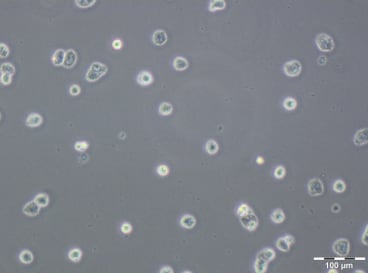 Figure 3. A2780 PTX (128) Cell Line. 24 hours after plating. Reprinted from Szenajch J. et al. 2020. Int. J. Mol. Sci. 21(23): 9218. 