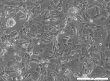 PEO16 Cell Line. Image courtesy of the European Collection of Authenticated Cell Cultures (ECACC)