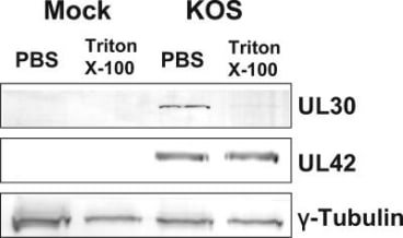 Adapted from Chen Y, Livingston CM, Carrington-Lawrence SD, Bai P, Weller SK. A mutation in the human herpes simplex virus type 1 UL52 zinc finger motif results in defective primase activity but can recruit viral polymerase and support viral replication efficiently. J Virol. 2007 Aug;81(16):8742-51. doi: 10.1128/JVI.00174-07. Epub 2007 Jun 6. PMID: 17553899; PMCID: PMC1951384.The viral polymerase UL30 was detergent-extracted from HSV-1-infected cells. Vero cells were either mock infected or infected with HSV WT strain KOS for 6 h. Cells were treated with either PBS or 0.5% Triton X-100 extraction buffer, followed by Western blotting using antisera raised against UL30 (top), UL42 (middle), or γ-tubulin (bottom) as described in Materials and Methods.