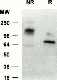 Adapted from Cornish et al. 1998. Blood; 92 (6): 2123–2132. PMID: 9731071 Figure. Western blot analyses of neutrophil lysates with anti–siglec-5 antiserum. Samples, either reduced (R) or nonreduced (NR), were separated on a 10% polyacrylamide gel and transferred to nitrocellulose. The blot was incubated with anti–siglec-5 antiserum at 1:2,000 dilution or preimmune serum at 1:1,000 dilution, washed, and incubated with 125I-antirabbit IgG. No signal was observed with preimmune serum (not shown) but a predominant band at approximately 70 kD and approximately 140 kD can be seen under reducing and nonreducing conditions, respectively.