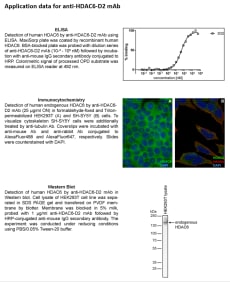 Image for Anti-HDAC6-D2 (3D2) mouse monoclonal antibody (D2 domain-specific)