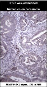 Wax embedded IHC using 2C3 at a dilution of 1/32.