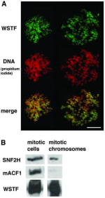 Adapted from Bozhenok L, Wade PA, Varga-Weisz P. WSTF-ISWI chromatin remodeling complex targets heterochromatic replication foci. EMBO J. 2002 May 1;21(9):2231-41. doi: 10.1093/emboj/21.9.2231. Erratum in: EMBO J 2002 Jun 17;21(12):3212. PMID: 11980720; PMCID: PMC125993. WSTF binds mitotic chromosomes. (A) Anti-WSTF staining (FITC, green) of spread mitotic chromosomes from NIH 3T3 cells, and propidium iodide staining for DNA (red, middle). Bottom: merged image (yellow). Bar = 10 µm. (B) Western blot analysis of whole mitotic NIH 3T3 cells and purified mitotic chromosomes. Each sample contains the same amount of chromatin.