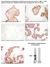 Immunohistochemical detection of DLX4 in human placenta using a 1:1000 – 1:1500 dilution of whole serum Rabbit anti-DLX4 (PINC Catalogue No. Rb1-151106-WS)