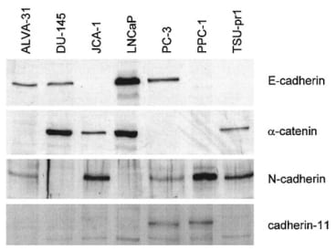 From Bussemakers et al. Int J Cancer. 2000 Feb 1;85(3):446-50. Western blot analysis of E‐cadherin (120 kDa), α‐catenin (102 kDa), N‐cadherin (130 kDa), and cadherin‐11 (115 kDa) in 7 human prostate cancer cell lines.