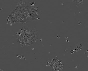 C70 Colorectal adenocarcinoma Cell Line. 7 days post plating. Image courtesy of the European Collection of Authenticated Cell Cultures (ECACC).