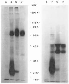 From Spits et al J Immunol September 1, 1985, 135 (3) 1922-1928.
"Comparison of target antigens recognized by anti-Leu-4. WT-31 and T40/25 by electrophoresis analysis. HPR-ALL cells were iodinated with '"I by the iodogen method. Immunoprecipitates were prepared as described in Materials and Methods. Immunoprecipitates were subjected to electrophoresis with 5 mM iodoacetamide (nonreducing conditions) or to 5% v/v mercaptoethanol (reducing conditions) present in sample buffers. Lane A. Preformed complex preclear of lysate under nonreducing conditions. B. anti-Leu-4 under nonreducing conditions: C. WT-31 under nonreducing conditions: D. T40/25 under nonreducing conditions. E. preformed complex preclear of lysate under reducing coning conditions. F. anti-Leu-4 under reducing conditions: G. WT-31 under reducing conditions. H. T40/25 under reducing conditions."