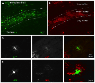 Clone 12 used to detect MBP in myelinating cell cultures using Immunofluorescence, Immunohistochemistry of transplanted neurospheres demonstrate that cyto-GFP labelled cells form early and mature myelinating oligodendrocytes.Cyto-GFP-expressing neurospheres were transplanted into a shiverer mouse 3, 7 or 15 days post-transplantation, and 10 µm thick frozen sections were cut and immunolabelled with antibodies to GFP and MBP. Source: Ioannidou et al. 2012. PLoS One. 7(1):e30775. PMID: 22303455.
