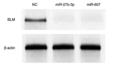 Chen et al. Molecular Medicine REPORTS 19: 4819-4831, 2019
Western blot analysis of BLM protein expression levels in PC3 cells at 24 h after miR or NC mimic transfection. NC, negative control; miR, microRNA; BLM, BLM RecQ like helicase.