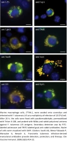 Image for Anti-F. tularensis LVS LpnA/Tul4 [14] Antibody