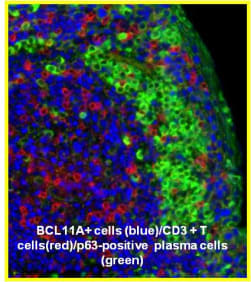 BCL11A<sub>XL</sub> is absent in plasma cells
BCL11A+ cells (blue)  /CD3+ T cells (red) / p63-positive plasma cells (green)
