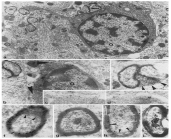 MBP Clone 1 used to detect MBP expression in myelin sheaths of adult rats by ICC. Source: Brunner et al. 1989. J Neurochem. 52(1):296-304. PMID: 2462020.
