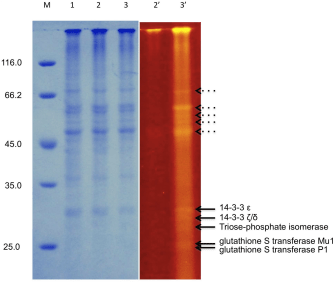 Flu-PAGE analysis of TASTPM mouse cortex homogenates. Flu-PAGE gel profile of TASTPM cortex homogenates, visualised with Dark ReaderH (right panel, lanes 29 and 39) prior to Coomassie staining (left panel, lanes 1–3). The solid arrows indicate the positions of the proteins that have been identified using MALDI-TOF analysis. The dotted arrows represent higher molecular weight fluorescent proteins to be investigated.