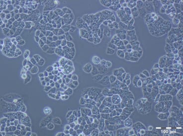 Figure 4: A2780 PTX (32) Cell Line. 120 hours after plating. Ready for subculture.