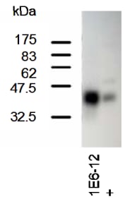 Western Blotting on 293T cell lysates (transfected) using anti-SCL [1E6]. + refers to serum from immunized mouse.